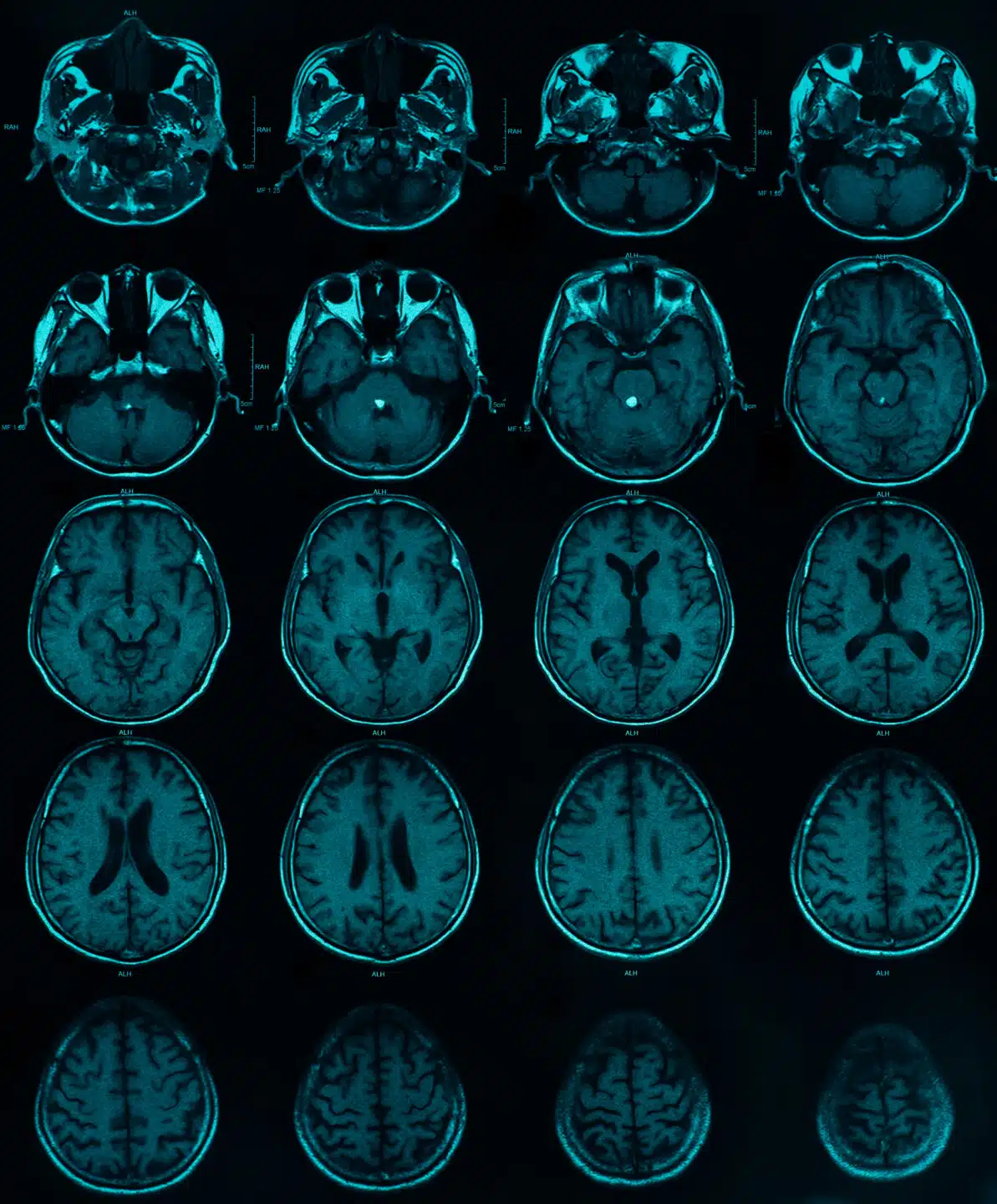 image of CT/MRI brain